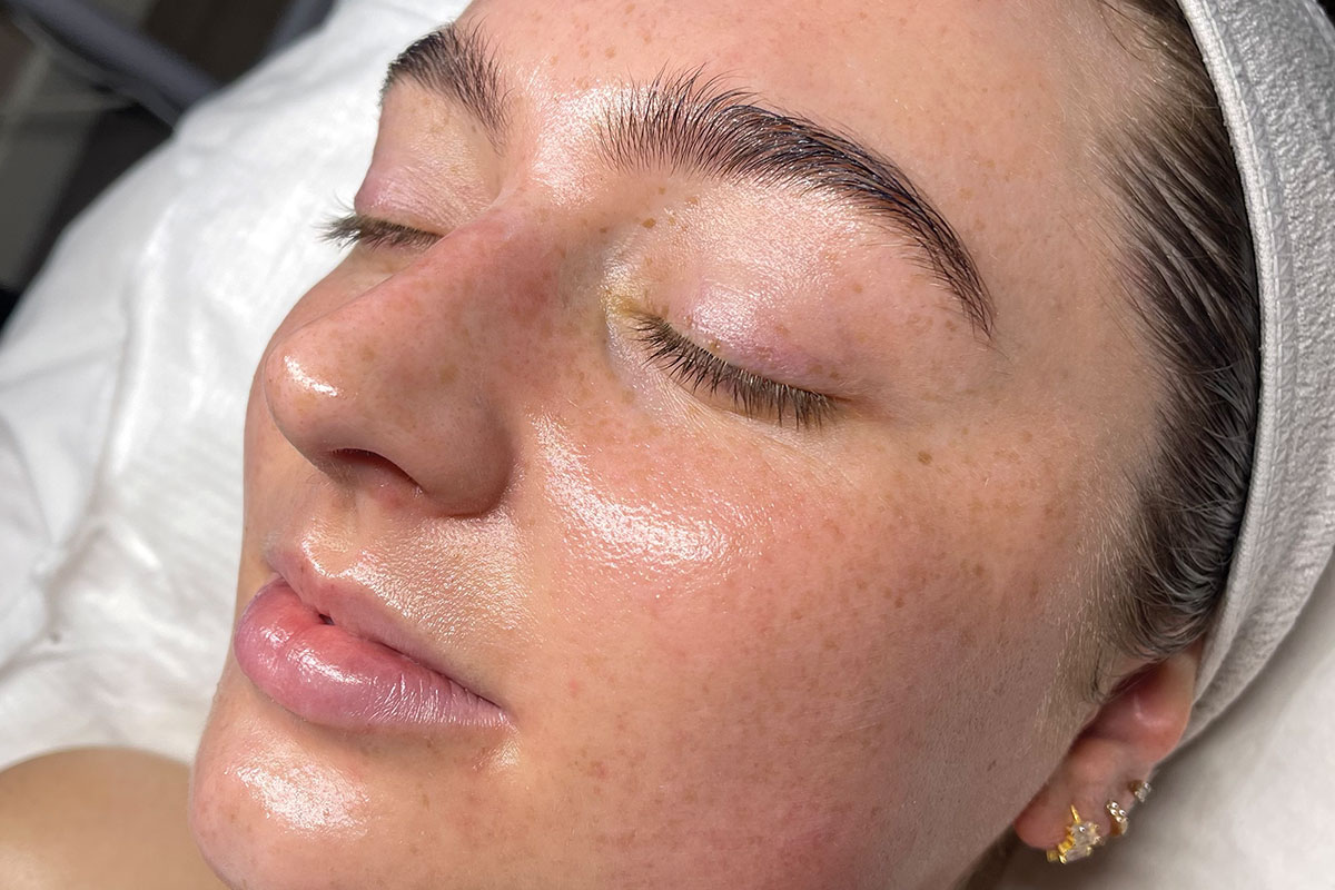Close-up of a woman receiving a bespoke glow facial treatment, her skin dewy and luminous with a white headband holding back her hair
